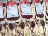 Ein Mensch mit der Blutgruppe A hat auf seinen roten Blutkörpern (Erythrozyten-Oberfläche) das Antigen A, während bei Gruppe B das entsprechend Antigen B vorhanden ist. Blutgruppe AB bedeutet beide Antigene. Menschen der Blutgruppe 0 haben weder das A- noch das B-Antigen. Ein Mensch mit der Blutgruppe A hat auf seinen roten Blutkörpern (Erythrozyten-Oberfläche) das Antigen A, während bei Gruppe B das entsprechend Antigen B vorhanden ist. Blutgruppe AB bedeutet beide Antigene. Menschen der Blutgruppe 0 haben weder das A- noch das B-Antigen.