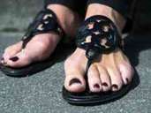In Sandalen fühlen sich Frauen mit ausgeprägtem Hallux valgus häufig am wohlsten. Denn die schiefstehende große Zehe drückt in geschlossenen Schuhen. Unbehandelt führt ein Hallux valgus häufig auch zu Knieschmerzen. Foto: Andrea Warnecke/dpa-tmn In Sandalen fühlen sich Frauen mit ausgeprägtem Hallux valgus häufig am wohlsten. Denn die schiefstehende große Zehe drückt in geschlossenen Schuhen. Unbehandelt führt ein Hallux valgus häufig auch zu Knieschmerzen. Foto: Andrea Warnecke/dpa-tmn