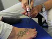 Wer sich ein Tattoo stechen lässt, glaubt in der Regel, es für immer behalten zu wollen. Überlegt man es sich anders, ist es nicht so einfach, die Farbe in der Haut wieder loszuwerden. Foto: Jörg Donecker/dpa-tmn Wer sich ein Tattoo stechen lässt, glaubt in der Regel, es für immer behalten zu wollen. Überlegt man es sich anders, ist es nicht so einfach, die Farbe in der Haut wieder loszuwerden. Foto: Jörg Donecker/dpa-tmn