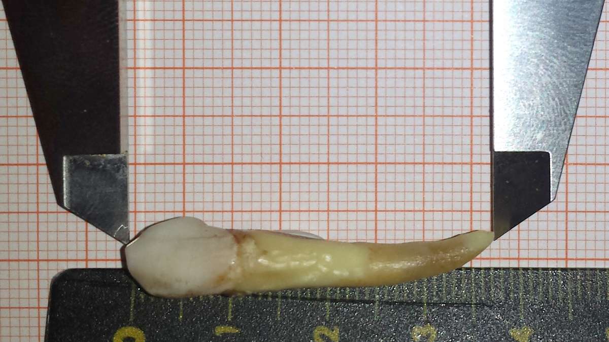 Längster Zahn der Welt: Mainzer Zahnarzt stellt Weltrekord auf | Gesundheit - blickpunkt-nienburg.de